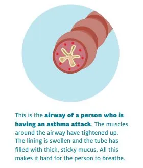 Managing your child's asthma HE2549